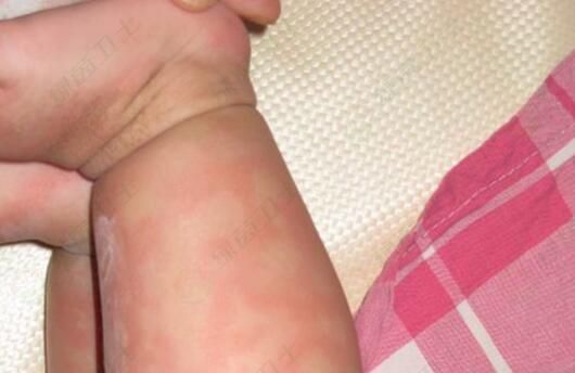 什么是大氣污染